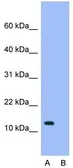 Anti-RPS16 antibody, N-term used in Western Blot (WB). GTX46159