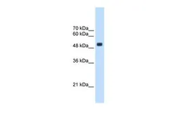 Anti-CXORF34 antibody, Internal used in Western Blot (WB). GTX46162