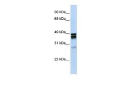 Anti-NUDT18 antibody, N-term used in Western Blot (WB). GTX46167