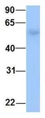 Anti-OXCT2 antibody, Internal used in Western Blot (WB). GTX46174