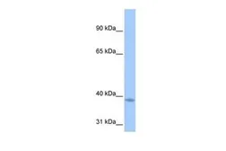 Anti-NSUN3 antibody, C-term used in Western Blot (WB). GTX46175