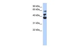 Anti-NSUN3 antibody, Internal used in Western Blot (WB). GTX46176