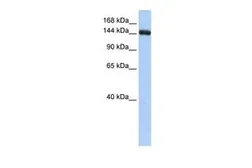 Anti-UGCGL2 antibody, Internal used in Western Blot (WB). GTX46178
