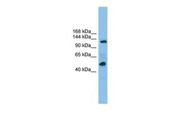 Anti-POLR1B antibody, Internal used in Western Blot (WB). GTX46181