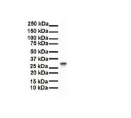 Anti-ECHDC2 antibody, Internal used in Western Blot (WB). GTX46184