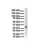 Anti-ECHDC2 antibody, Internal used in Western Blot (WB). GTX46185