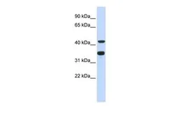 Anti-POLD2 antibody, N-term used in Western Blot (WB). GTX46203