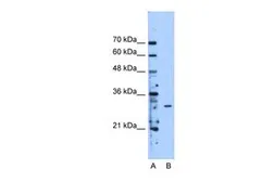 Anti-METTL1 antibody, Internal used in Western Blot (WB). GTX46207