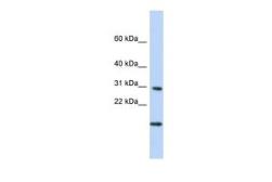 Anti-POLR2K antibody, Internal used in Western Blot (WB). GTX46208