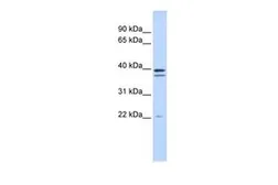 Anti-RABGGTB antibody, Internal used in Western Blot (WB). GTX46212