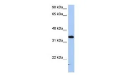 Anti-SULT6B1 antibody, C-term used in Western Blot (WB). GTX46218