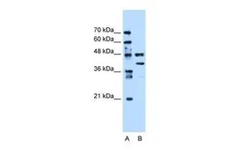 Anti-EEF1G antibody, Internal used in Western Blot (WB). GTX46253