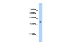 Anti-Aldolase A antibody, N-term used in Western Blot (WB). GTX46257