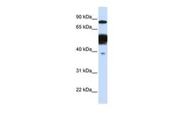 Anti-NEXN antibody, Internal used in Western Blot (WB). GTX46266