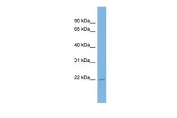 Anti-C13ORF28 antibody, Internal used in Western Blot (WB). GTX46270