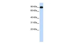 Anti-CTAGE5 antibody, Internal used in Western Blot (WB). GTX46273
