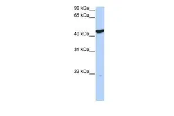 Anti-Cytokeratin 23 antibody, Internal used in Western Blot (WB). GTX46291