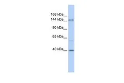 Anti-ADCY10 antibody, N-term used in Western Blot (WB). GTX46292