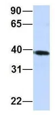 Anti-CARKD antibody, Internal used in Western Blot (WB). GTX46301