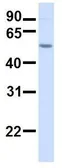 Anti-TMEM16K antibody, C-term used in Western Blot (WB). GTX46308