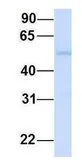Anti-SUSD4 antibody, N-term used in Western Blot (WB). GTX46312