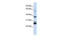 Anti-FAM70A antibody, N-term used in Western Blot (WB). GTX46314