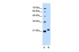 Anti-C1ORF159 antibody, Internal used in Western Blot (WB). GTX46317