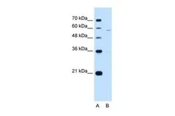 Anti-PIGV antibody, N-term used in Western Blot (WB). GTX46322