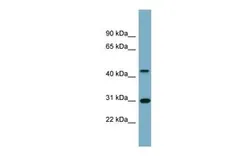 Anti-ARMCX3 antibody, Internal used in Western Blot (WB). GTX46335