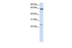 Anti-TMEM138 antibody, N-term used in Western Blot (WB). GTX46339