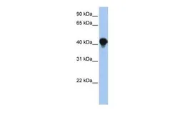 Anti-PTPLAD1 antibody, N-term used in Western Blot (WB). GTX46341