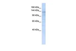 Anti-IMPG2 antibody, C-term used in Western Blot (WB). GTX46342