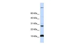 Anti-C19ORF56 antibody, N-term used in Western Blot (WB). GTX46346