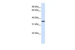 Anti-TXNDC14 antibody, Internal used in Western Blot (WB). GTX46347