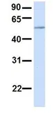 Anti-PIGT antibody, C-term used in Western Blot (WB). GTX46349