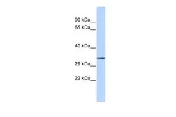 Anti-TEX264 antibody, Internal used in Western Blot (WB). GTX46350