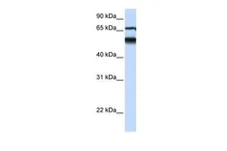 Anti-ATL3 antibody, Internal used in Western Blot (WB). GTX46354