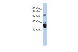 Anti-LRRC8B antibody, N-term used in Western Blot (WB). GTX46359