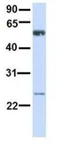 Anti-ALG6 antibody, N-term used in Western Blot (WB). GTX46386