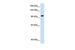 Anti-SEC63 antibody, C-term used in Western Blot (WB). GTX46399