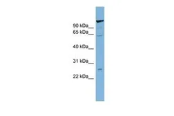 Anti-C6ORF10 antibody, Internal used in Western Blot (WB). GTX46401