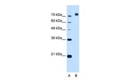 Anti-CORIN antibody, C-term used in Western Blot (WB). GTX46410