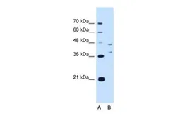 Anti-EVI2B antibody, Internal used in Western Blot (WB). GTX46414