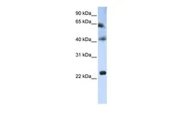 Anti-TSPAN3 antibody, Internal used in Western Blot (WB). GTX46420