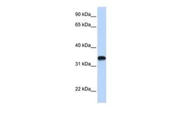 Anti-HAS3 antibody, C-term used in Western Blot (WB). GTX46424