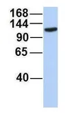 Anti-SERCA3 antibody, Internal used in Western Blot (WB). GTX46427