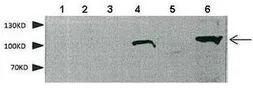 Anti-SEMA4F antibody, N-term used in Western Blot (WB). GTX46442