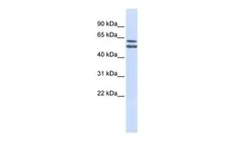 Anti-PIGQ antibody, N-term used in Western Blot (WB). GTX46444