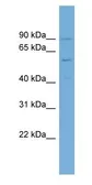 Anti-PIGQ antibody, N-term used in Western Blot (WB). GTX46445