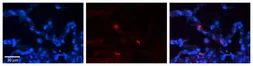 Anti-FCGRT antibody, N-term used in IHC (Paraffin sections) (IHC-P). GTX46447